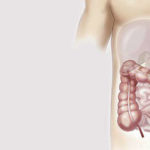 Obstrucción intestinal: síntomas, diagnóstico y tratamiento: tratamiento del intestino irritable heelprobiotics heelespana 150x150 - HeelEspaña
