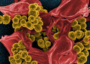 Microbiota y Sobrepeso - ¿Están relacionadas?: beneficios bacterias microbiota intestinal heelprobiotics heelespana 300x214 - HeelEspaña