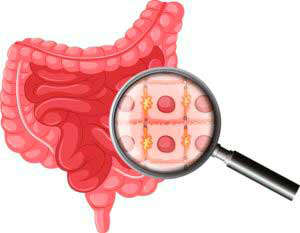 Microbiota intestinal y enfermedades: microbiota enfermedades investigacion heelespana 300x233 - HeelEspaña