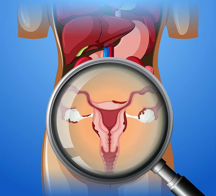 Causas de la infección urinaria recurrente en mujeres: prevencion infeccion urinaria recurrente heelespana - HeelEspaña