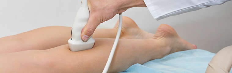 Tratamiento para las varices en las piernas: tratamiento varices - HeelEspaña