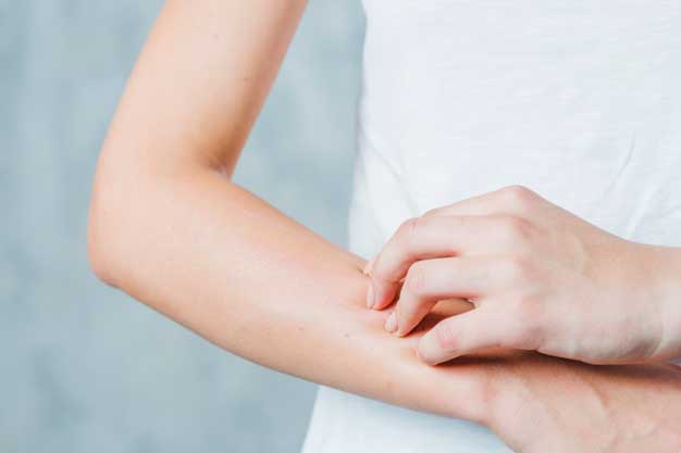 Nuevas evidencias para el tratamiento de la dermatitis atópica