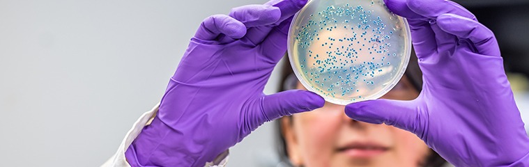 La composición de la microbiota puede determinar la respuesta frente al Covid