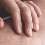Cómo cuidar la microbiota de la piel