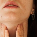 Pólipos nasales por inflamación de la mucosa: faringitis cronica 150x150 - HeelEspaña