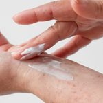 Biotina para cuidar la piel: beneficios y propiedades: xerosis 150x150 - HeelEspaña
