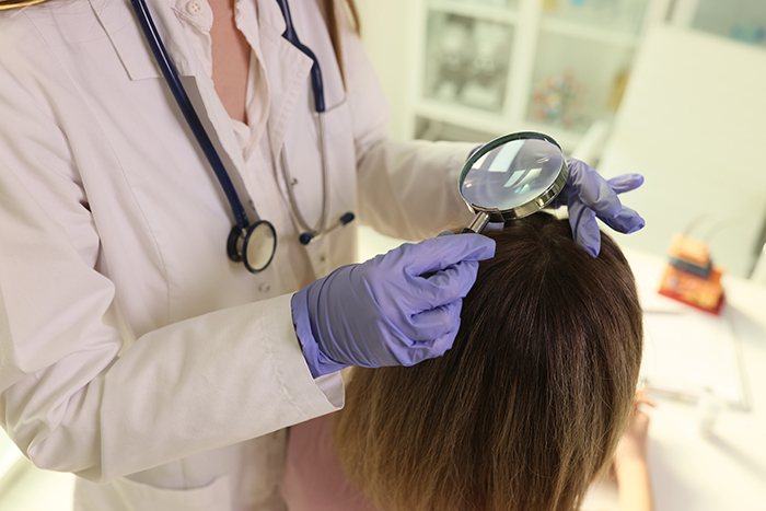 Estrategias de prevención y tratamiento de la caída del cabello en mujeres: el papel de los profesionales sanitarios: medico alopecia femenina - HeelEspaña