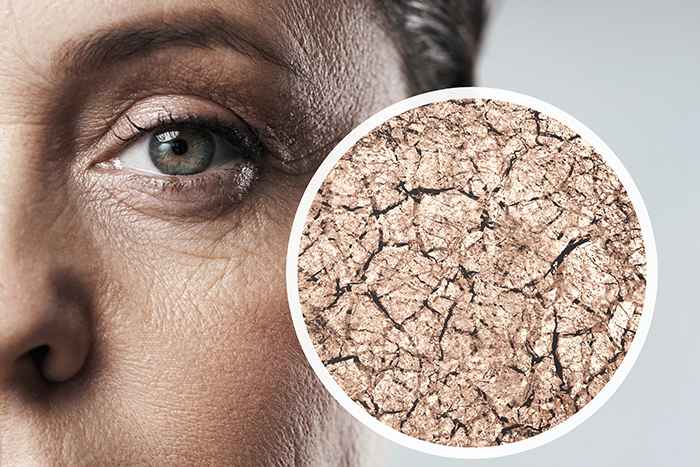 ¿Cómo afecta la deshidratación a la estructura de la piel?: sequedad estructura piel - HeelEspaña